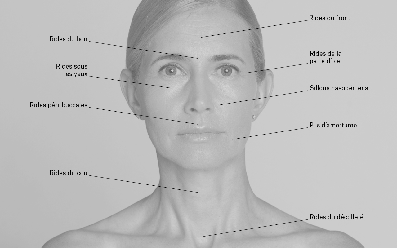 Schéma des zones du visage à traiter