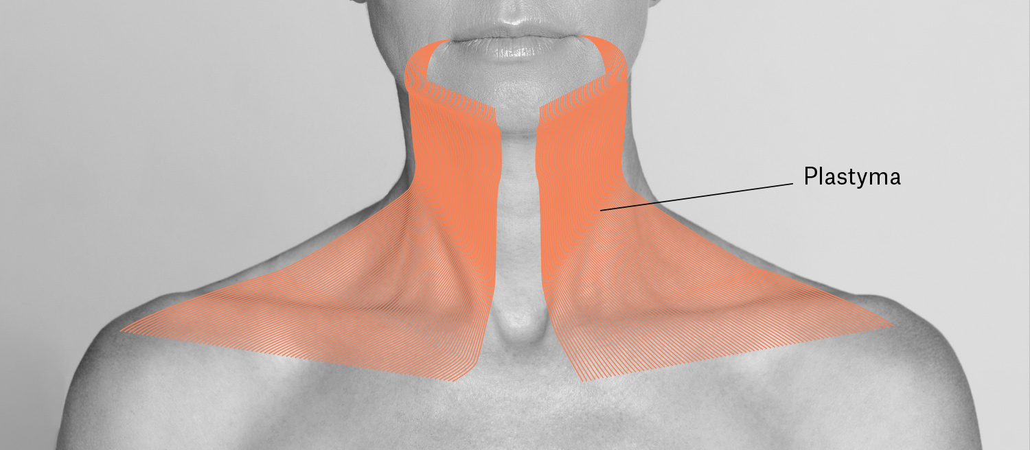 Le platysma est un muscle situé sous la peau du cou