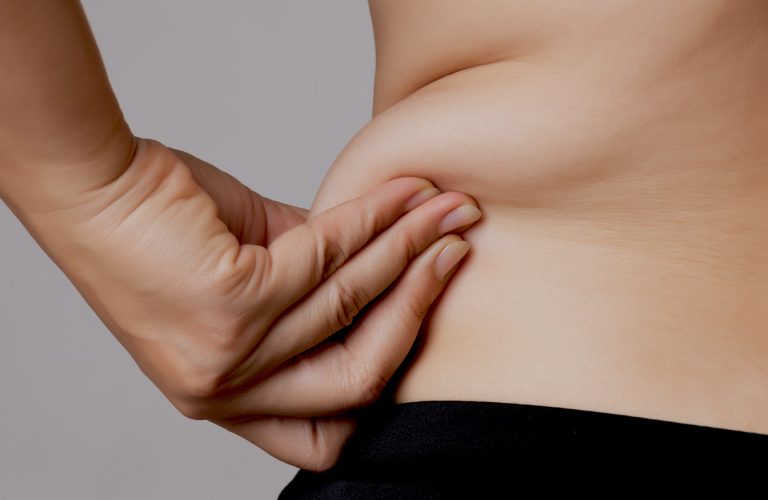 La graisse sous-cutanée peut être traitée efficacement grâce aux techniques de chirurgie esthétiques du Dr Zanzi.